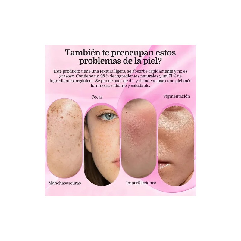 Crema De Arbutina 7% + Ácido Tranexámico Al 4%, 70.000