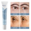 Sérum Rejuvenecedor De Ojos Para La Zona De Los Ojos