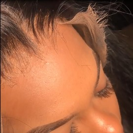 SKINLIKE Real HD Lace Frontal Human Hair Pre Plucked Natural Hairline Invisible HD Lace Closure Ultra Thin Swiss HD Lace Bleach Knots Closure Human Hair with Baby Hair (5x5 Hd Body Wave, 20 inch)