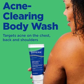 Differin Acne Body Wash de los creadores de Gel, limpiador para el tratamiento del acné con ácido salicílico, fórmula de crema para hacer espuma para espalda, pecho y hombros, 10 oz.