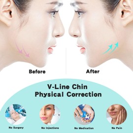 WIDVIH Silicone Chin Strap，V Line Mask Lifting Strap ，V Shaped Chin Mask for Women & Men (2PC)