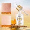 Serum Aclarante Manchas Acné Tratamiento Vitamina C 30m