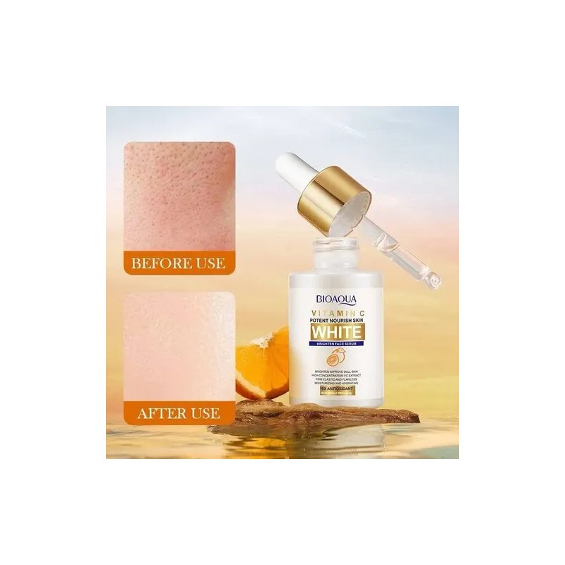 Serum Aclarante Manchas Acné Tratamiento Vitamina C 30m