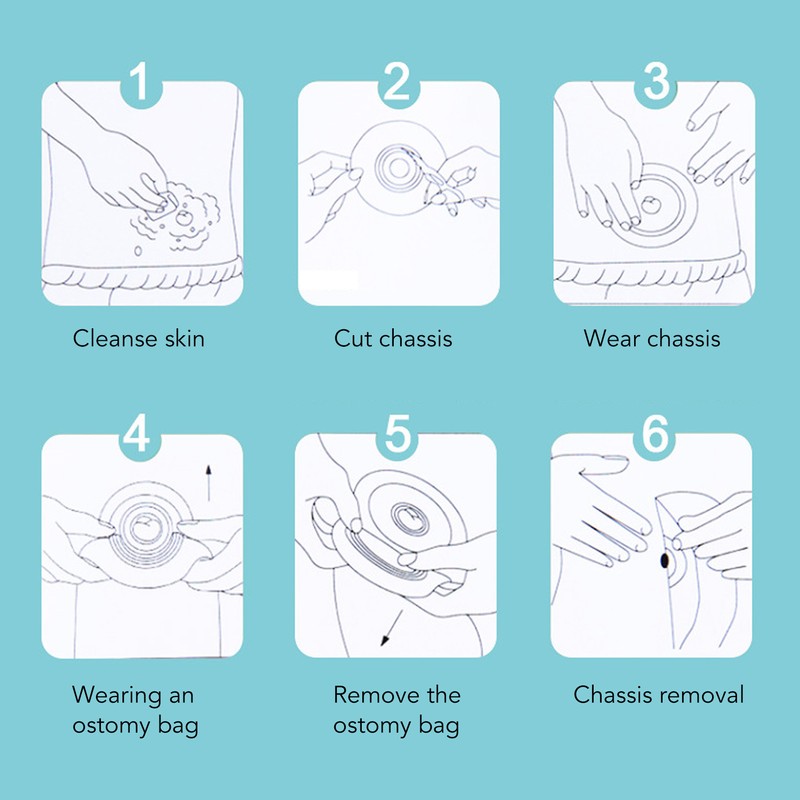 5pcs Ostomy Bag Barrier Clear Scale Cuttable Self Adhesive Hydrocolloid