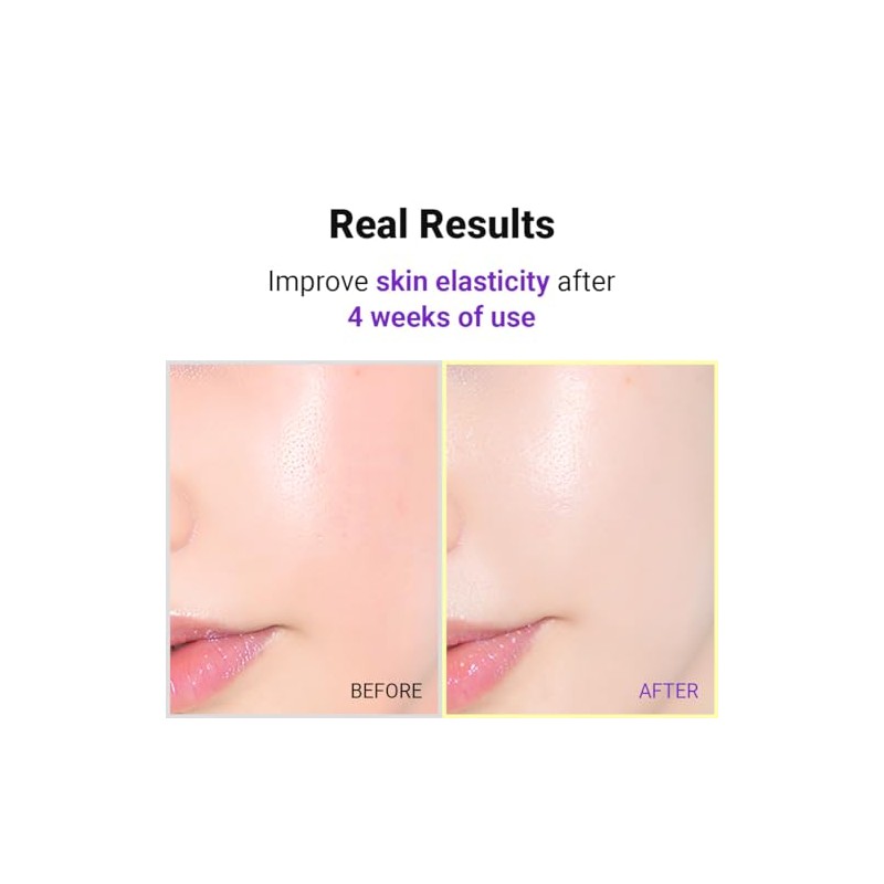 Suero ISNTREE Hyper Retinol EX 1.0 20 ml | Regalos