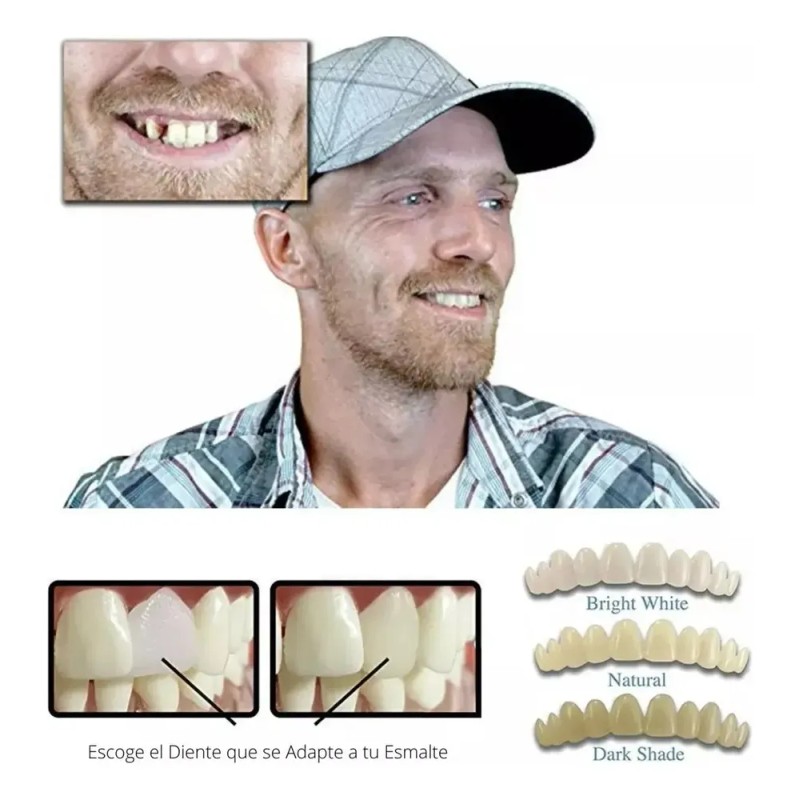 Dientes Postizos Temporal Falsos Reparación Rellenar