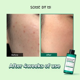 SOME BY MI AHA BHA PHA Calming Truecica Micellar Cleansing Water / 10.14Oz, 300ml / Mild Daily Cleansing Water for Sensitive Skin/Calming Effect, Absorb and Clean Waste/Facial Skin Care