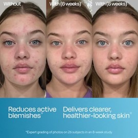 Murad Biome-Balancing Serum - Suero Facial Anti-Imperfecciones con Ácido Salicílico, Equilibra Microbioma - 30 ml