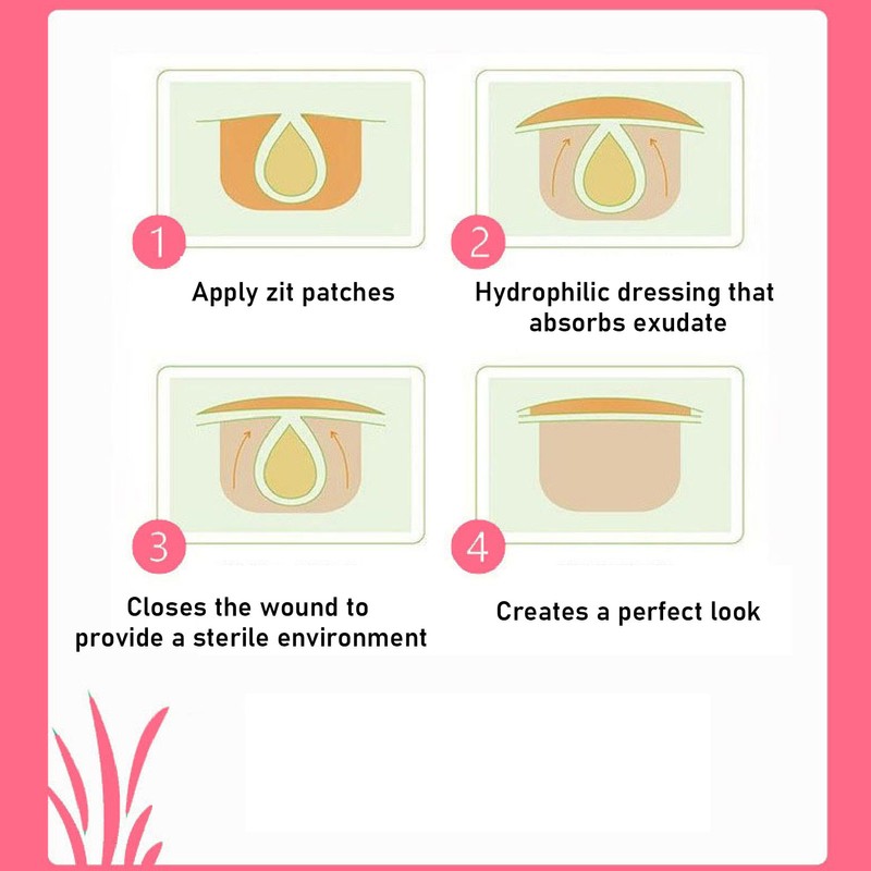 42pcs Pimple Healing Patches Reduce Swelling Diminish Blemishes Heart Shaped