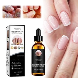Nagel Oil, 30ml Nagelpflege, Eingewachsene Zehennägel Tropfen, Natural Ingrown Toenail Correction Oil, Nail Essence Serum, Nagelpflege Serum für Brüchige, fur Gebrochene und Verfärbte Nägel