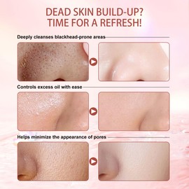 Gentle Purifying Exfoliating Gel for improving Skin Tone & Texture, Deas Skin Cells/Pore Dirt/Excess Sebum/Impurities Remover, Hydration, Natural Formula, 1.76 Oz/50 G