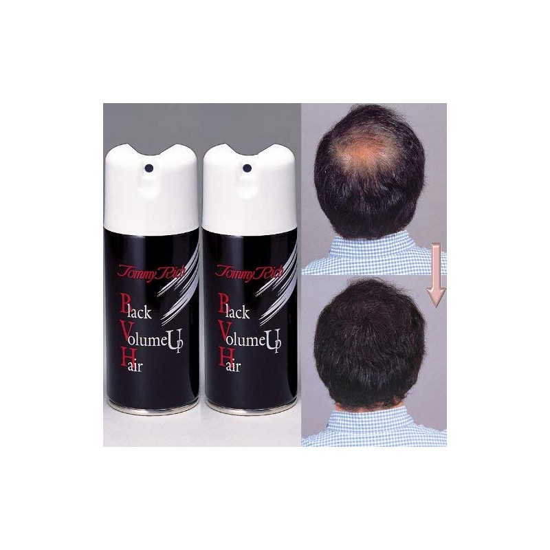 Thin Hair 地肌 to Cover for a of Black Hair