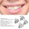 40pcs 2nd Molar Single Buccal Tube 0.022in Reduced Oral Friction
