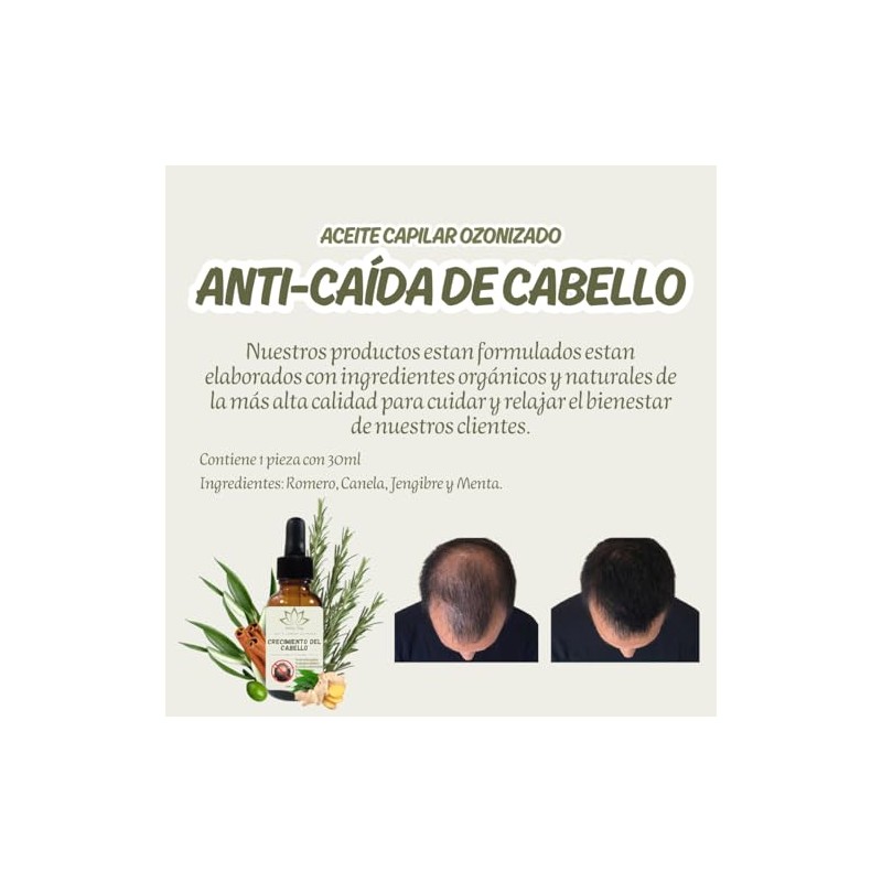 Aceite Capilar Ozonizado Romero Anti-caída de Cabello (30 ML)