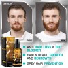 Unbranded Biotin Hair Growth Spray Anti Hair Loss Fast Regrowth