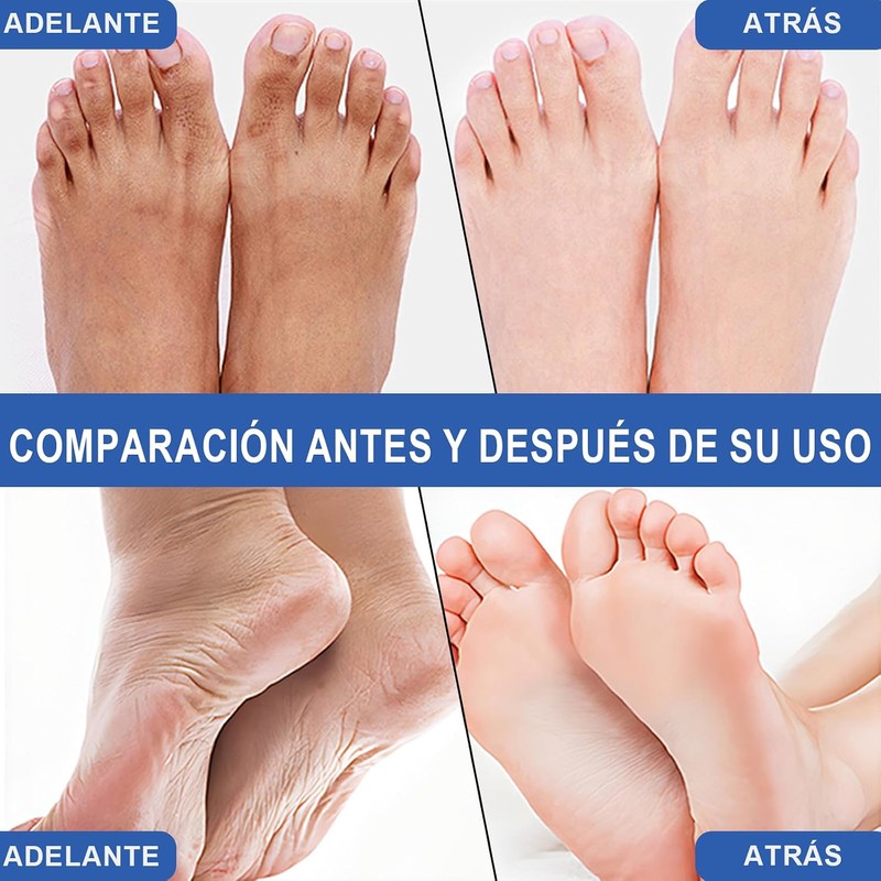 Crema Hidratante para Pies con Urea 60% y Ácido Salicílico
