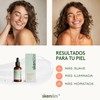 Skenties Sérum Hidratante con Ácido Hialurónico, Niacinamida y Vitamina E,