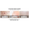 Hickstein [Hickstein] Deep Sebum Softening Extractor Sebum Removal Blackhead Care