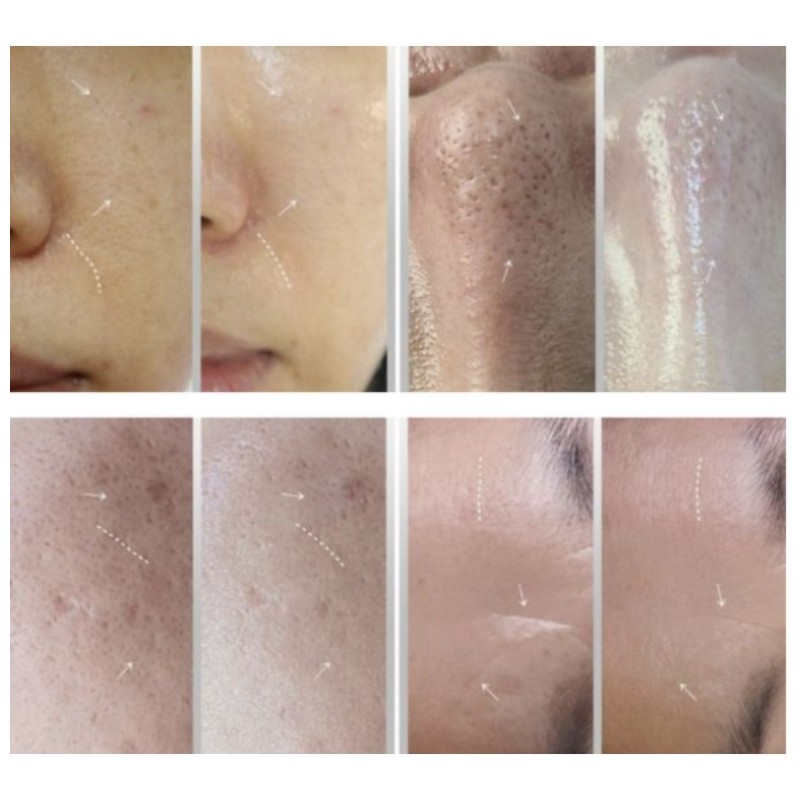 CONAPIDIL Cemenzal Light High Potency Cream 1ml*8pcs