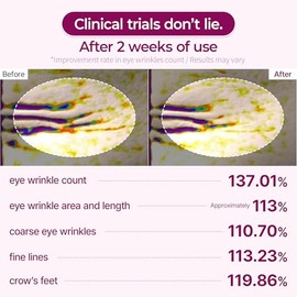 Dr.Melaxin Cemenrete Calcium Volume Parche En El Ojo 60Ea