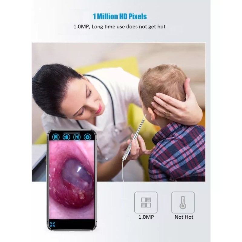 Teslong Otoscopio Digital Recargable Con Wifi Integrado. Ios Android