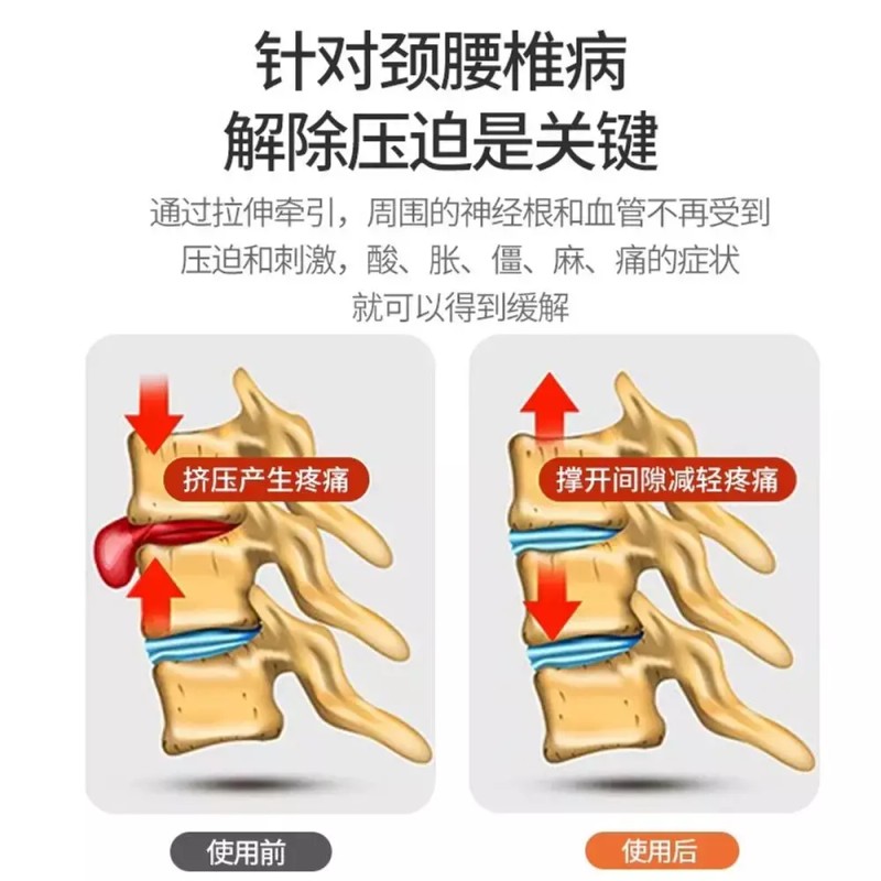 견인기 경추 장치 목 의자 가정용 재활운동 일자목 [H. 새로운