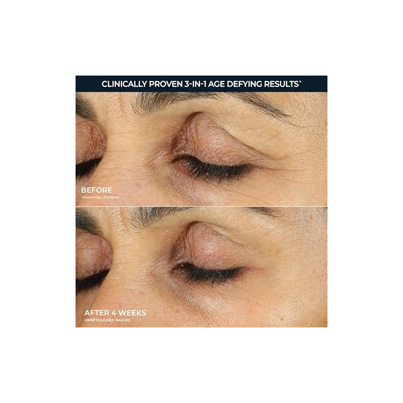 RoC Retinol Correxion Anti-Aging Eye Cream Treatment, 0.5 Fl Oz