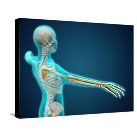 ART.COM Stretched Canvas Print X-Ray View of Human Body Showing Skeletal Bones in the Arm and Hand, 24" x 18"