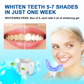 Shynova Teeth Bleaching Set for White Teeth: Teeth Whitening Kit with LED Light & 5x Bleaching Gel, Effective Teeth Whitening & Teeth Cleaning, Bleach Your Teeth at Home