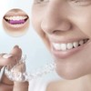 Chargenyang 15 Pcs Aligner Chewies for Invisalign Trays,Aligner Tray Seaters