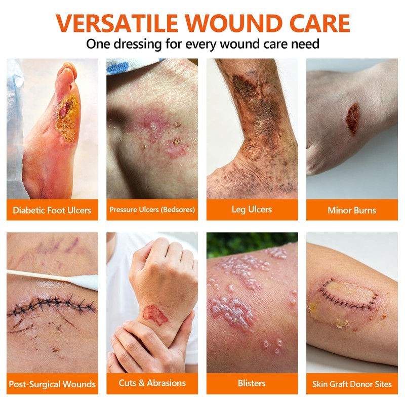 10 Pack Honey Wound Dressing,4'' x 4''Manuka Honey Gauze Dressing,Non-Stick