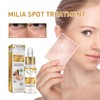 Milia Spot Serum for Face,Milia Treatment under Eye,Eye Serum for