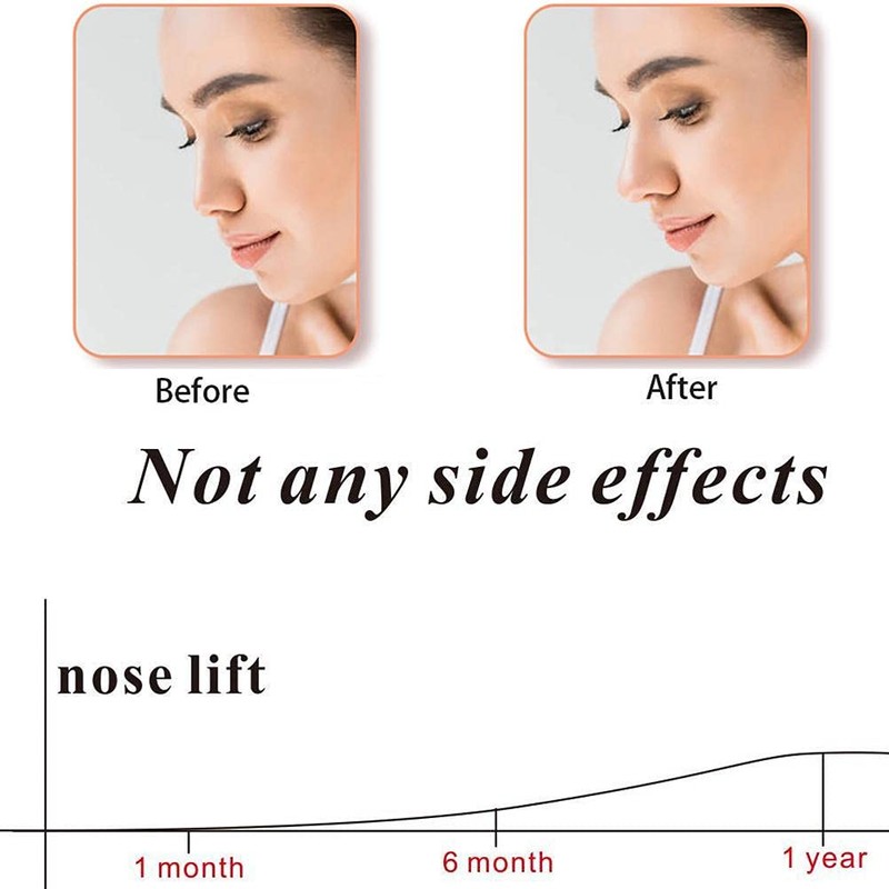 Shiker Silicone Nose Shaper Clip - 1PCS Nose Corrector Device
