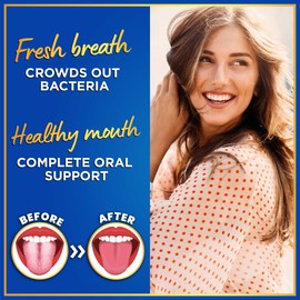 Oral Probiotics for Teeth and Gums - 3BN CFU Lactobacillus Salivarius Acidophilus Rhamnosus Streptococcus - Bad Breath Treatment for Adults - 45 Chewable Mint Dental Probiotic Tablets for Women & Men