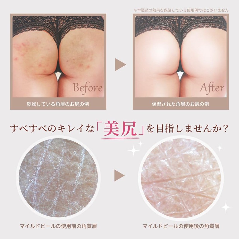 Body Soap for Butt Care, Back Acne, Peeling, Jewel Rain,