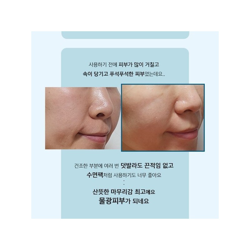 Anacis 리더미스 속건조 해결 판테놀 수분 로션 크림 앰플 3종