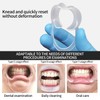 4-Pack Dental Mouth Openers - C-Shaped Cheek Retractors for Oral