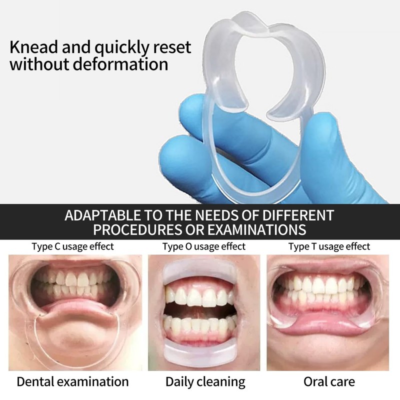 4-Pack Dental Mouth Openers - C-Shaped Cheek Retractors for Oral