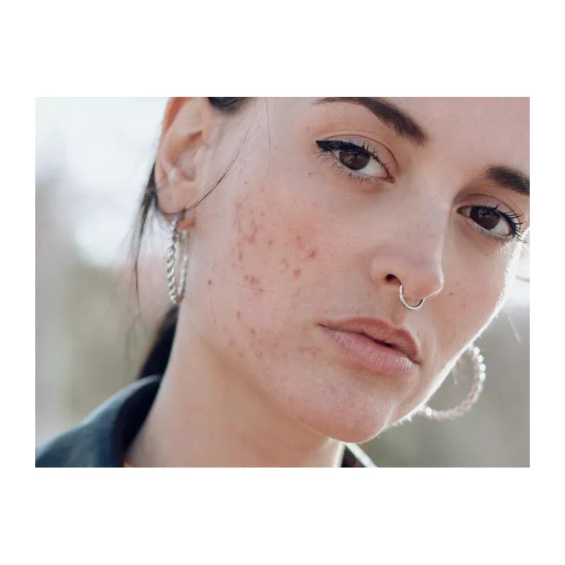 A3 Lemon Face Cream | Brightening & Control Stubborn Blemishes|400