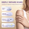 Reusable Silicone Scar Tape for Effective Scar Treatment
