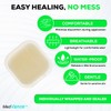 MedVance Hydrocolloid – Bordered Hydrocolloid Adhesive Dressing, 2"x2" Box of
