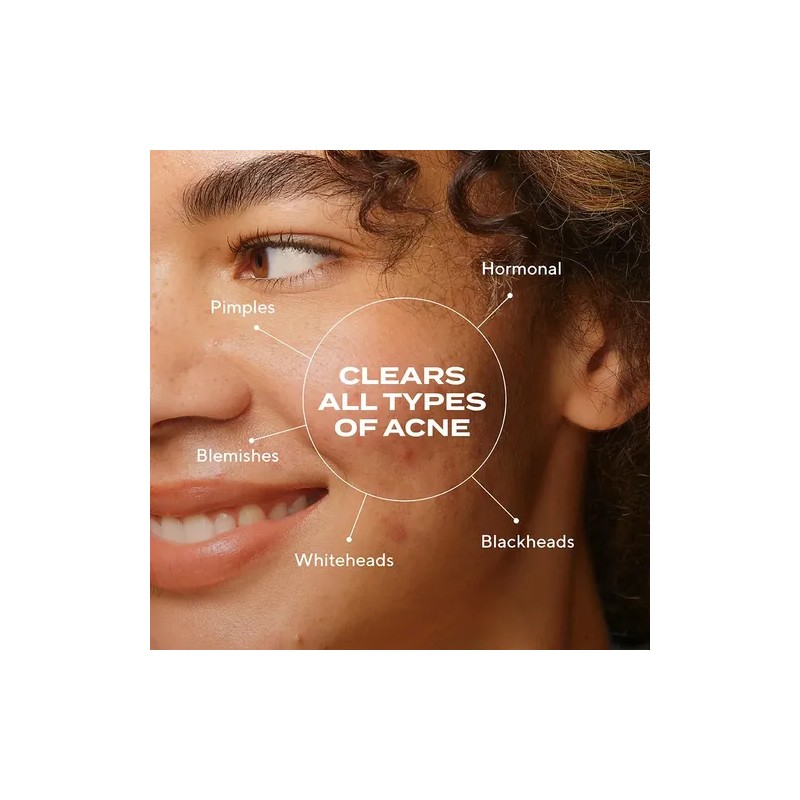 Tratamiento Antiacné Murad Biome-balancing: Suero Con Ácido