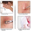 Pointed Blackhead Removal, 2-in-1 Acne Extractor Tool - Durable Stainless