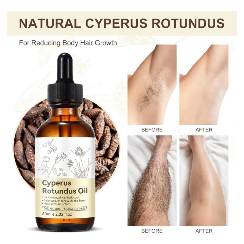 Aceite De Cyperus - Solución Natural De Depilación, Hidrata