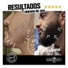 Roll On Manup Crecimiento Barba Y Cabello 6 Unidades