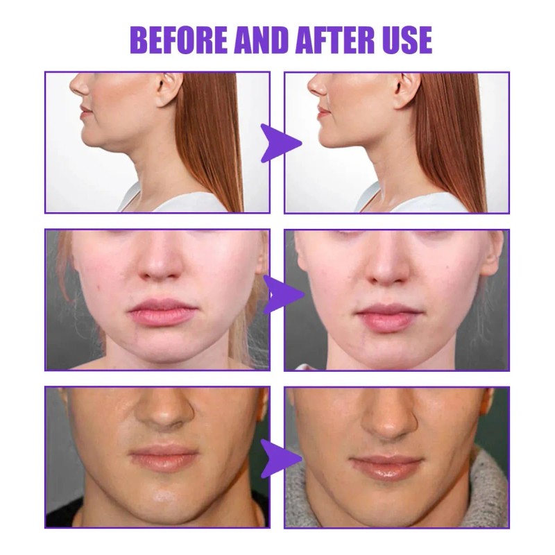 Crema Facial Jaysuing Hidratante Antiarrugas Lifting Mentón Día Noche