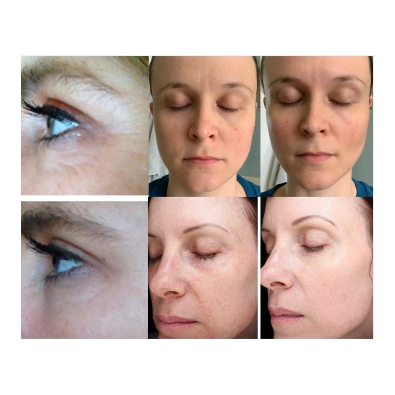 Rose Quartz Facial Jade Roller Massager + Butterfly Gua Sha