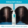 Aquavis® Regenerating Anti Hair Loss Shampoo with Aquavis, Vitamin B6,