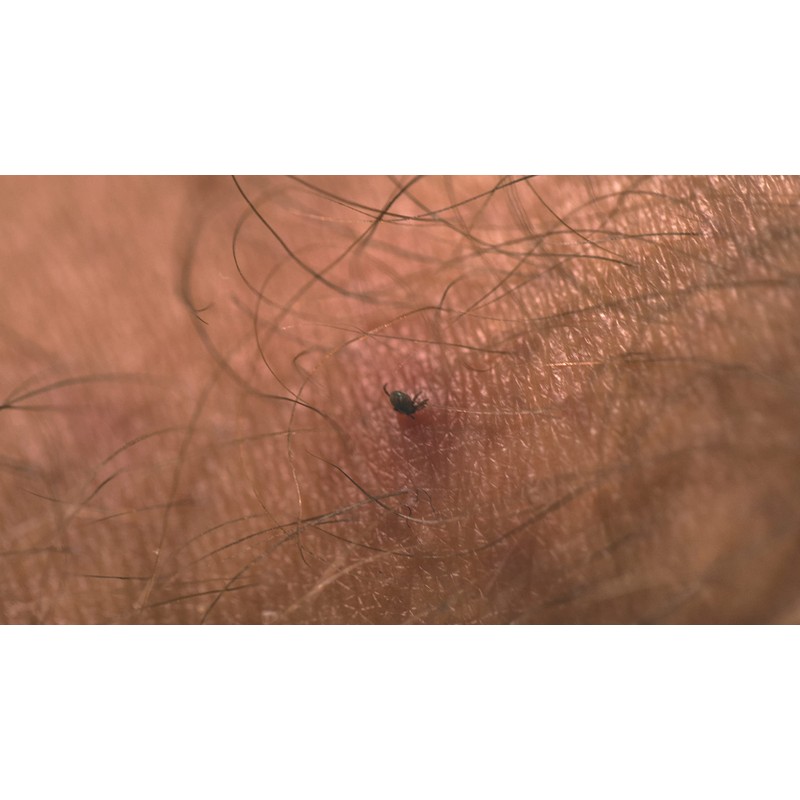 Lifesystems Tick Remover Credit Card Size with Magnifying Lens for
