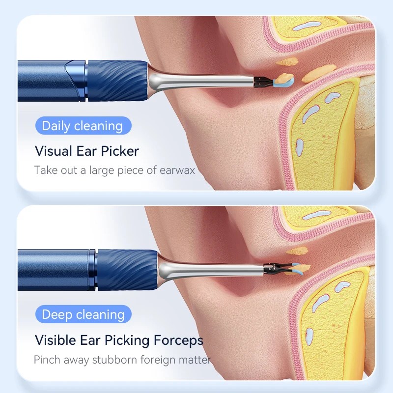 PAKISS Portable Wireless Otoscope Camera Intelligent Electric Visual Ear Cleaner